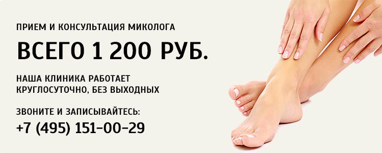 Где в рядом с динамо удалить бородавки Где в рядом с динамо удалить бородавки
